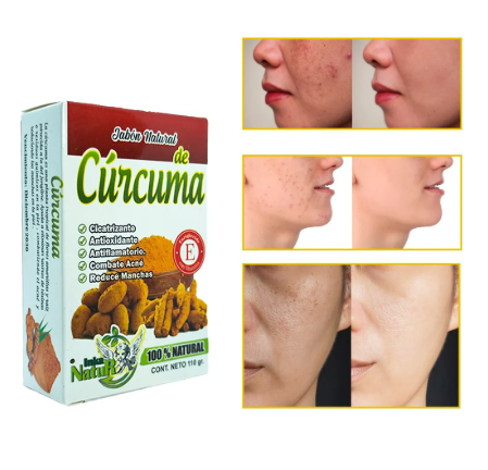 JABÓN DE CÚRCUMA 100% NATURAL